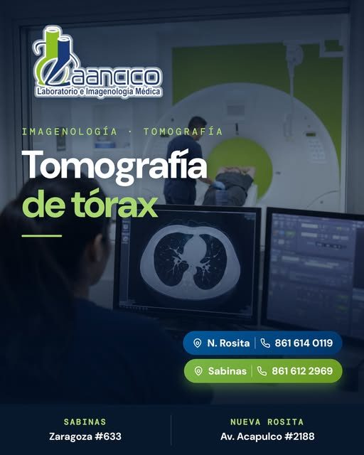 Tomografía de tórax en la Región Carbonífera.