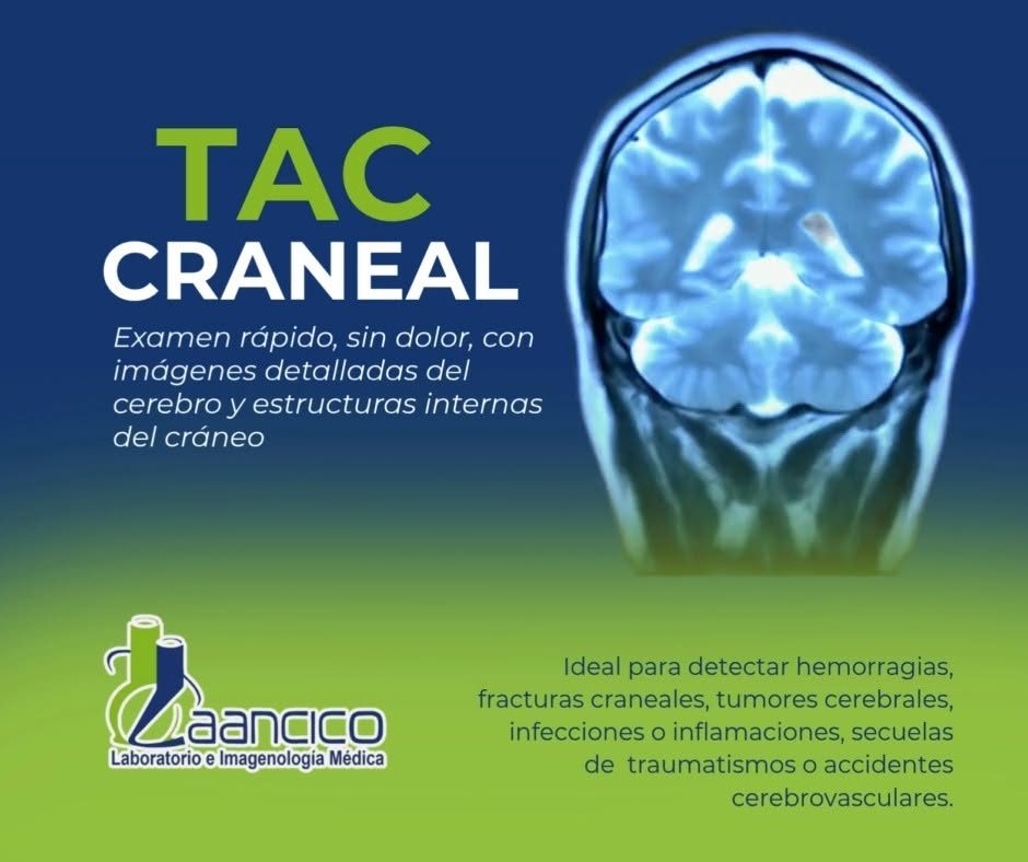 Reel de LAANCICO en Facebook