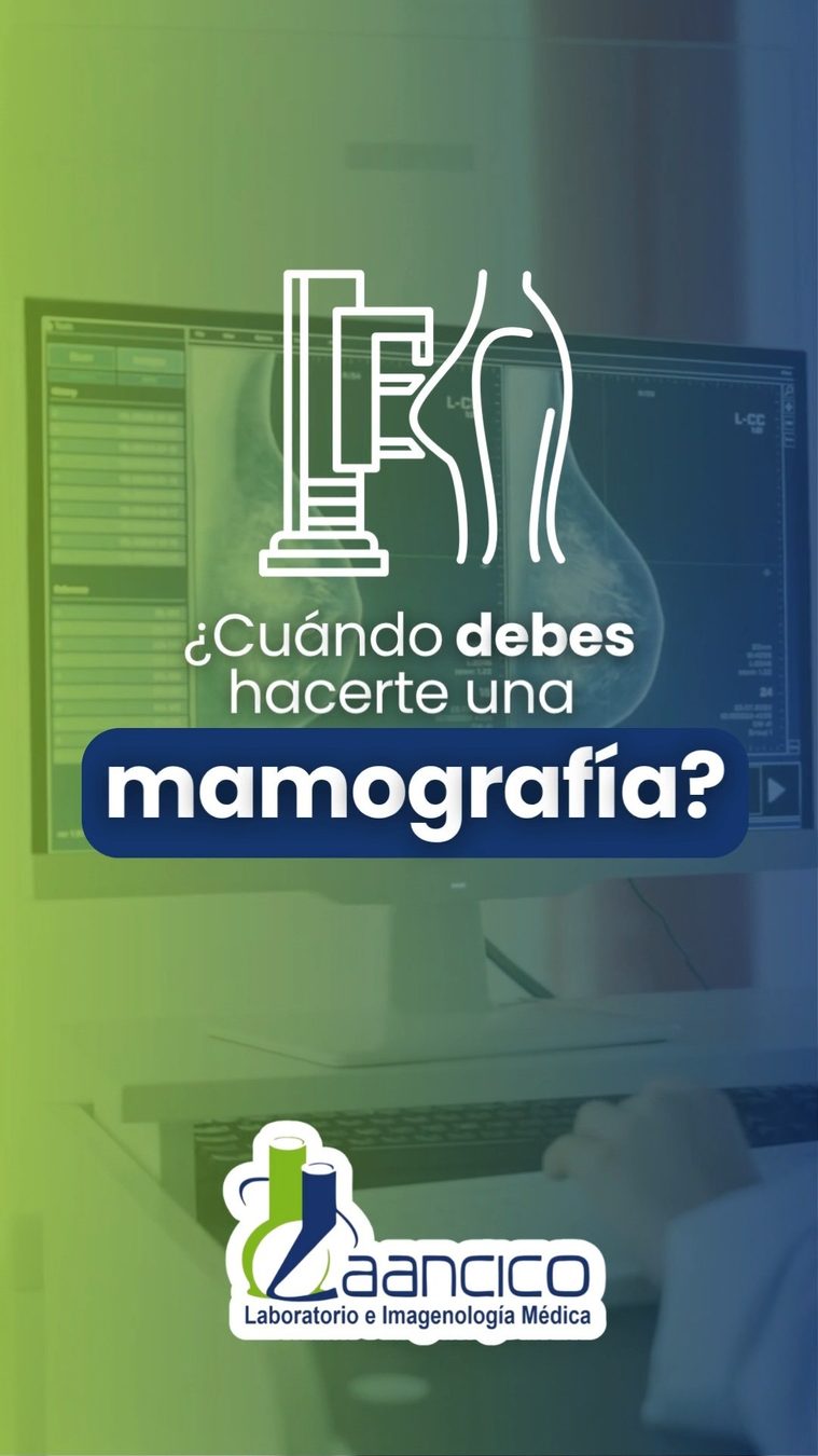 ¿Cuándo hacerte una mamografía?